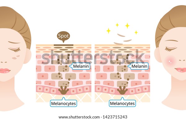 infographic skin cell turnover illustration.\
Melanin and melanocytes in human skin layer with woman face. beauty\
and skin care\
concept