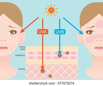 infographic skin illustration. the difference between UVA and UVB rays penetration
