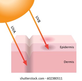 infographic skin illustration. the difference between UVA and UVB rays penetration