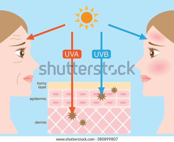 Infographic Skin Illustration Difference Between Uva Stock Vector ...