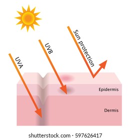 infographic skin illustration. UVA and UVB penetration into the human skin. sunscreen protect the skin from radiation.