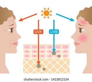 infographic skin layer illustration. the difference between UVA and UVB rays penetration