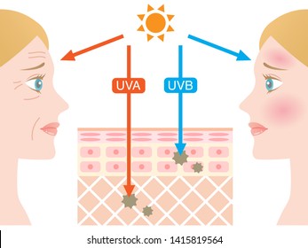 infographic skin layer illustration. the difference between UVA and UVB rays penetration