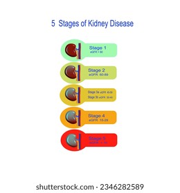 Infographic stages of chronic kidney disease