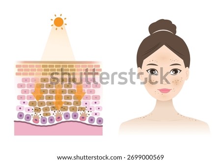 Infographic of UV rays penetrate into the epidermis skin layer, damage woman face, resulting in sunspots, age and dark spots vector illustration on white background. Skin care and beauty concept.