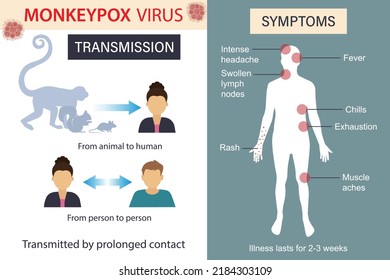 Infographics about monkey pox. Infection, symptoms, spread of monkeypox disease. Flat vector illustration.