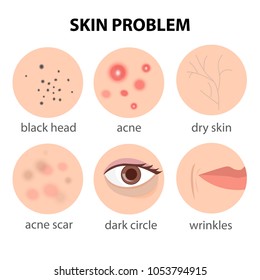 Infographics about the problem skin - acne, black dots, wrinkles, dry skin, acne spots. - Shutterstock ID 1053794915