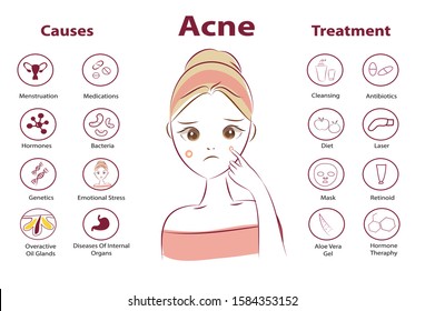 Infographics of acne. Causes of the disease, treatment for acne.Solutions for acne. Beauty cartoon illustration