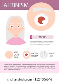 
Infographics Of Albinism