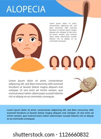 Infographics of alopecia
