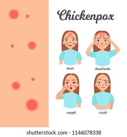 Infographics Chickenpox Causes Disease Stock Vector (Royalty Free ...