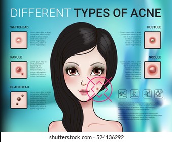 Infographics of different type of acne. Vector Illustration with skin problems.