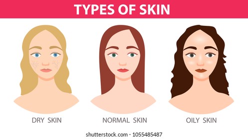 
Infographics different types of skin
