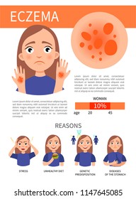Infographics of eczema. Skin problems. Illustration of a cute girl. Causes of the appearance of the disease.
