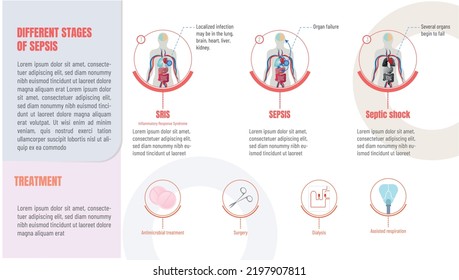 Infographics, Evolution Of Sepsis Stages And Possible Treatments