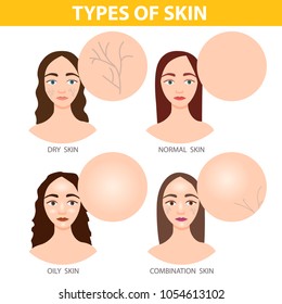 
Infographics Of Girls With Different Skin Types - Dry, Oily, Normal And Combination.