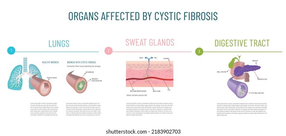 Infographics of the main organs affected by cystic fibrosis