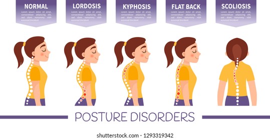 Infographics of posture disorders.  Types of posture. Illustration of cute girl.