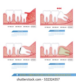 infographics several common problems has impact from wisdom teeth.