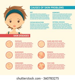 Infographics Of Skin Problems, The Causes Of Problem Skin, Types Of Problems. Girl With Acne, Pores, Scars, Pustules.