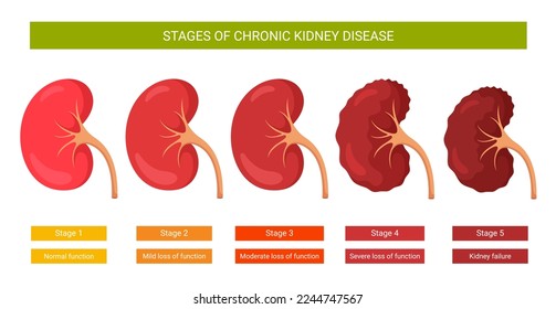 Infographics stages of chronic kidney disease