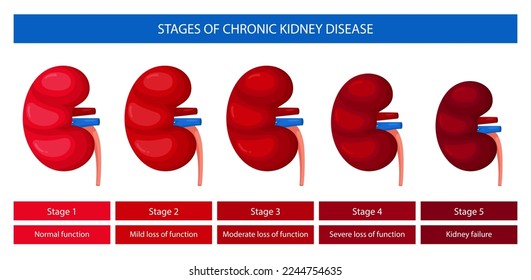 Estadios infográficos de la enfermedad renal crónica