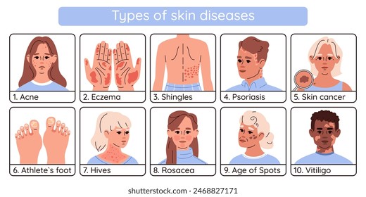 Infographics of types of skin diseases. Scheme of different
dermatological skin diseases young and old people.