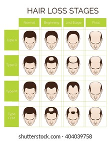 Hairline Chart