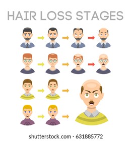 Information chart of hair loss stages types of baldness illustrated on male head vector.