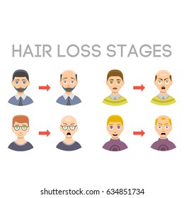 Information chart of hair loss stages types of baldness illustrated on male head vector.