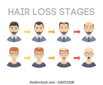 Information chart of hair loss stages types of baldness illustrated on male head vector.