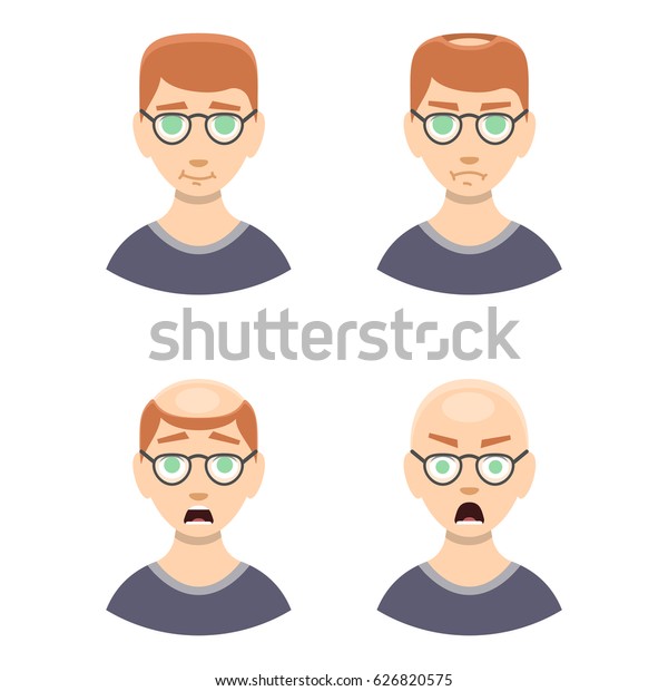 Information Chart Hair Loss Stages Types Stock Vector Royalty