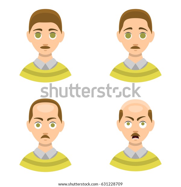 Information Chart Hair Loss Stages Types Stock Vector Royalty