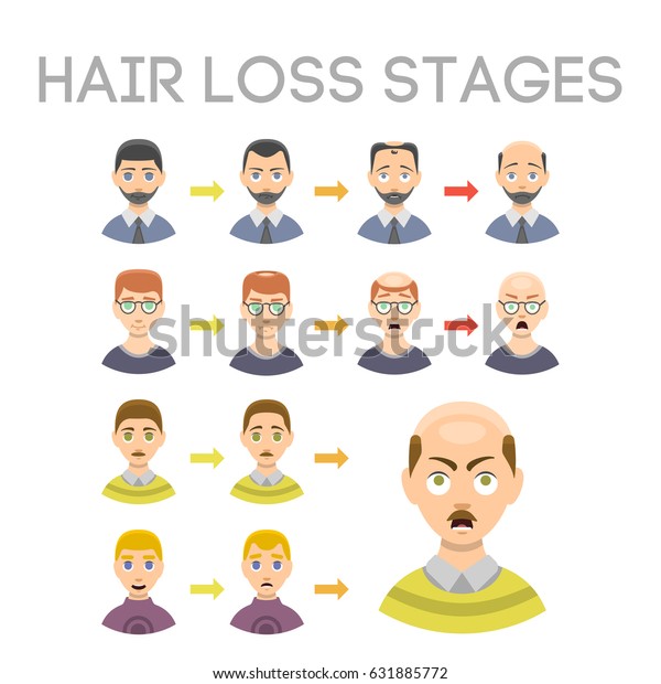 Information Chart Hair Loss Stages Types Stock Vector Royalty