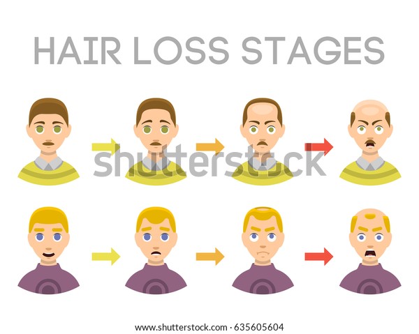 Information Chart Hair Loss Stages Types Stock Vector Royalty