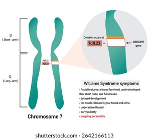 Information infographic of Williams syndrome that's a genetic disorder resulting from the loss of multiple genes in the 7q11.23 region of chromosome 7.	