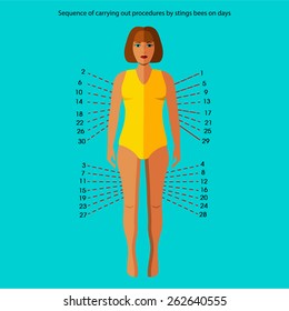 The information poster containing information on an order of carrying out procedures of stings of bees. Alternative medicine