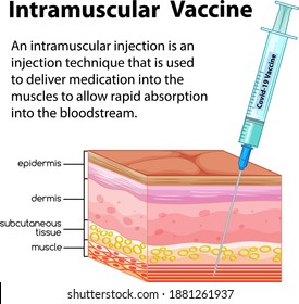 where do you give a dog an im injection