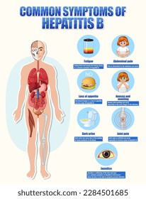 Informative poster of common symptoms Hepatitis B illustration