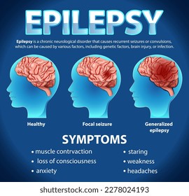 Afiche informativo de la ilustración de la epilepsia