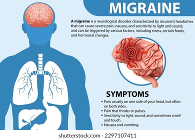 Informative poster of Migraine illustration