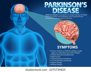 Informative poster of Parkinson disease illustration