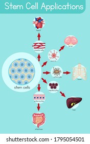 Informative poster of stem cell applications illustration