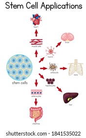Informative Poster Stem Cell Applications Illustration Stock Vector ...