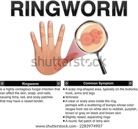 Ringworm Drawing | Free download on ClipArtMag