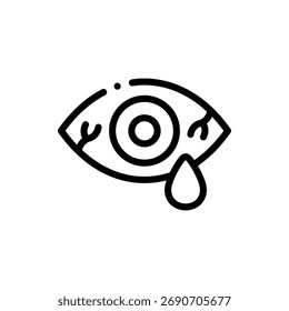 Informative vector illustration of conjunctivitis symptoms, suitable for medical, health, and awareness graphics