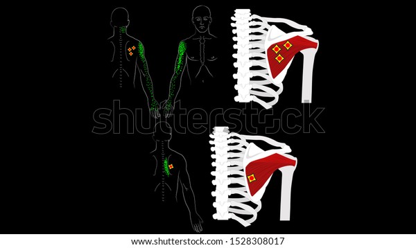 Infraspinatus muscle.\
The deep muscles of the arm. Trigger points and pain in the arm and\
shoulder blade. The structure of the muscles of the hands. Vector\
image on a black\
background.