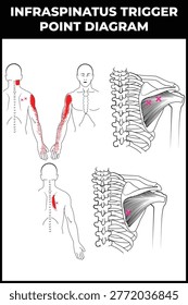 Infraspinatus Trigger Point Vector Diagram