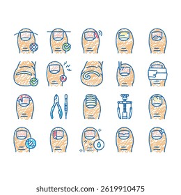Ingrown Nail Disease Collection doodle icons set vector. Psoriasis Onychomycosis, Nail Dark Spots Surgical Intervention Medical Therapy