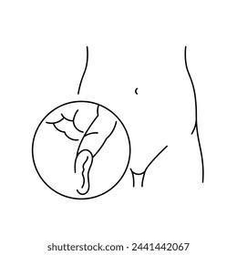 Inguinal hernia line icon. Vector isolated element. Editable stroke.